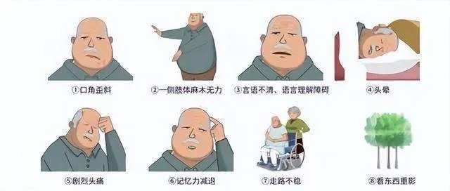 警惕身体发出的警报，脑中风的前兆有哪些症状